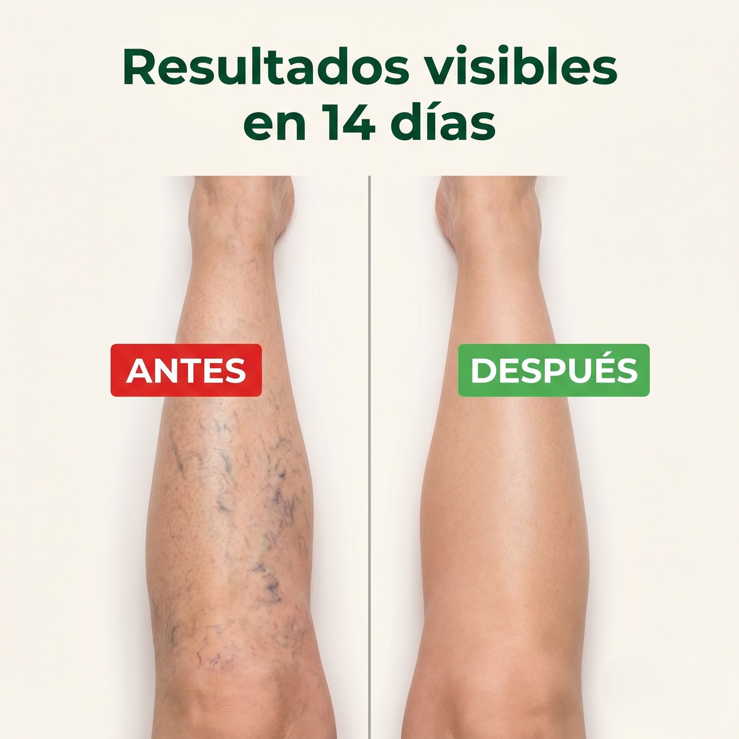 VeinClear Pro™ - Crema Hidratante para Piernas Cansadas
